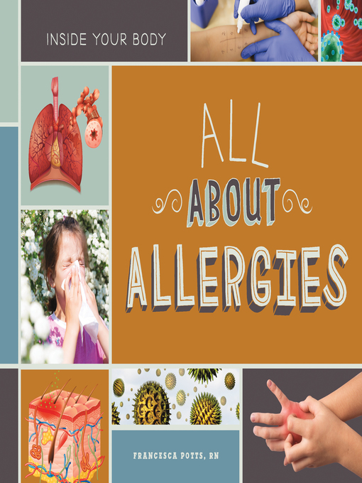 Title details for All About Allergies by Francesca Potts, RN - Available